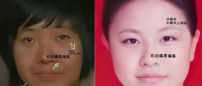 丰县八孩铁链女小花梅不是李莹-今朝观点-点点新媒体